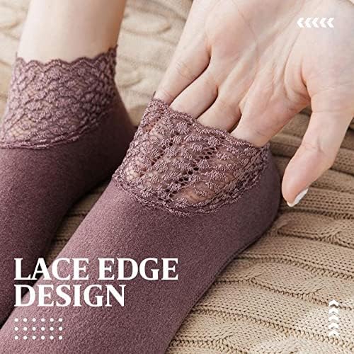 Elegant Lace Ankle Socks