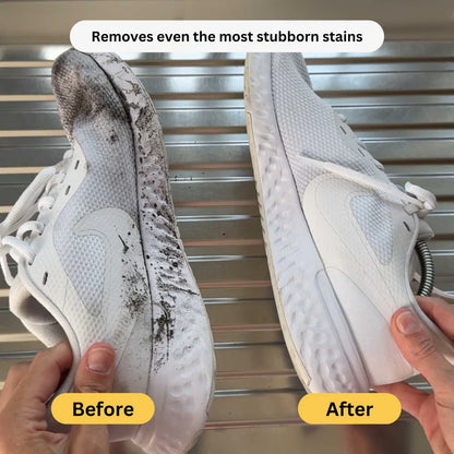 ShoeCare Pro™ Shoe Laundry Bag