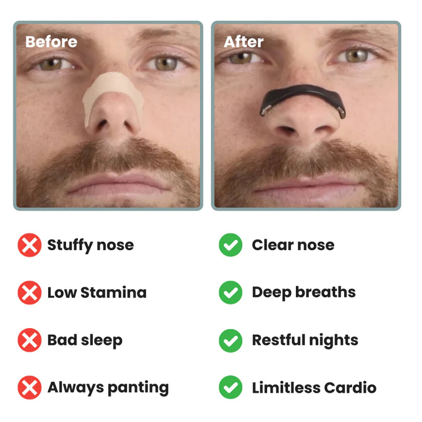 Magnetic Nasal Dilator Kit