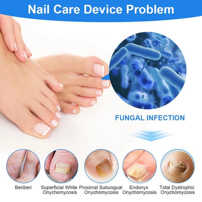 ✨ ClariNail™ 3-in-1 Nail Therapy Device